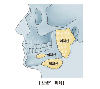 타액선암