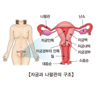 임질