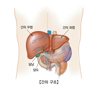 간세포성 암종