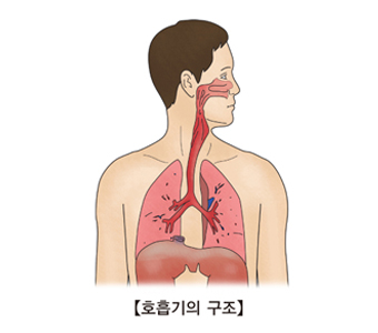 지역사회성 폐렴