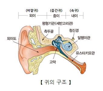 감각신경성 난청