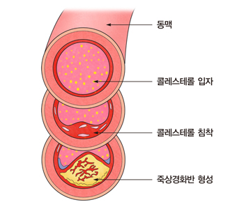 콜레스테롤