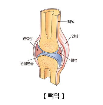 뼈막