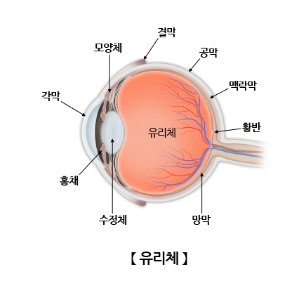 유리체