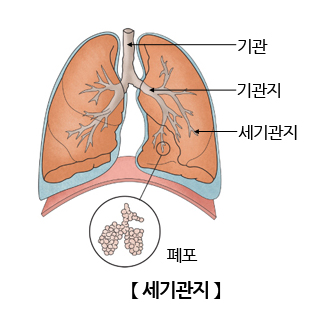 세기관지